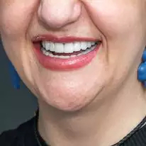 Slider image (7) Turkiye Dental